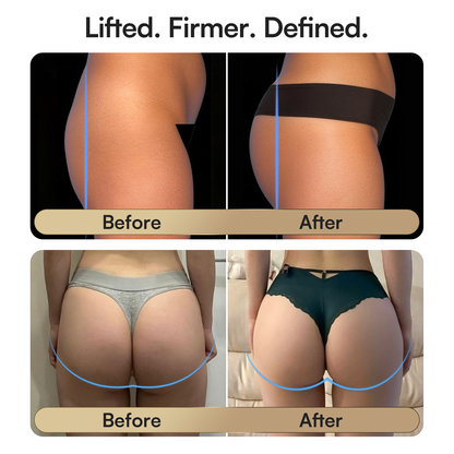 Zulizsel Curvify - EMS Toning Shorts